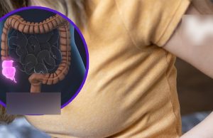 Appendix can.cer symptoms to look out for as ‘tip of the iceberg’ wa.rning is issued to millennials