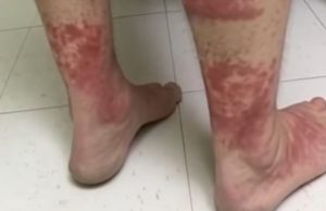 Here Are Some Problems That Can Happen If You Don’t Get Proper Sleep