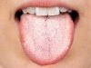 ATTENTION: This could be happening to you if you have a white tongue and…